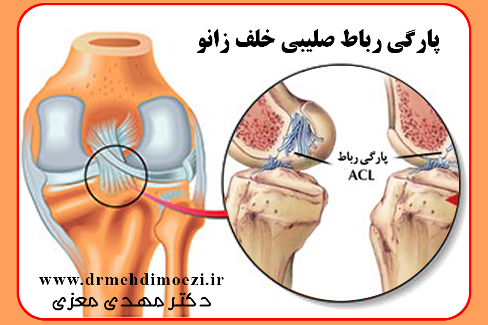 ارتوپدي اصفهان، بهترين ارتوپد اصفهان، بهترين جراح لگن اصفهان، دکتر مهدی معزی، ارتوپدی در اصفهان، ارتوپدی، متخصص ارتوپدی، جراح ارتوپدی